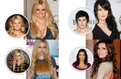 famosos com alongamento