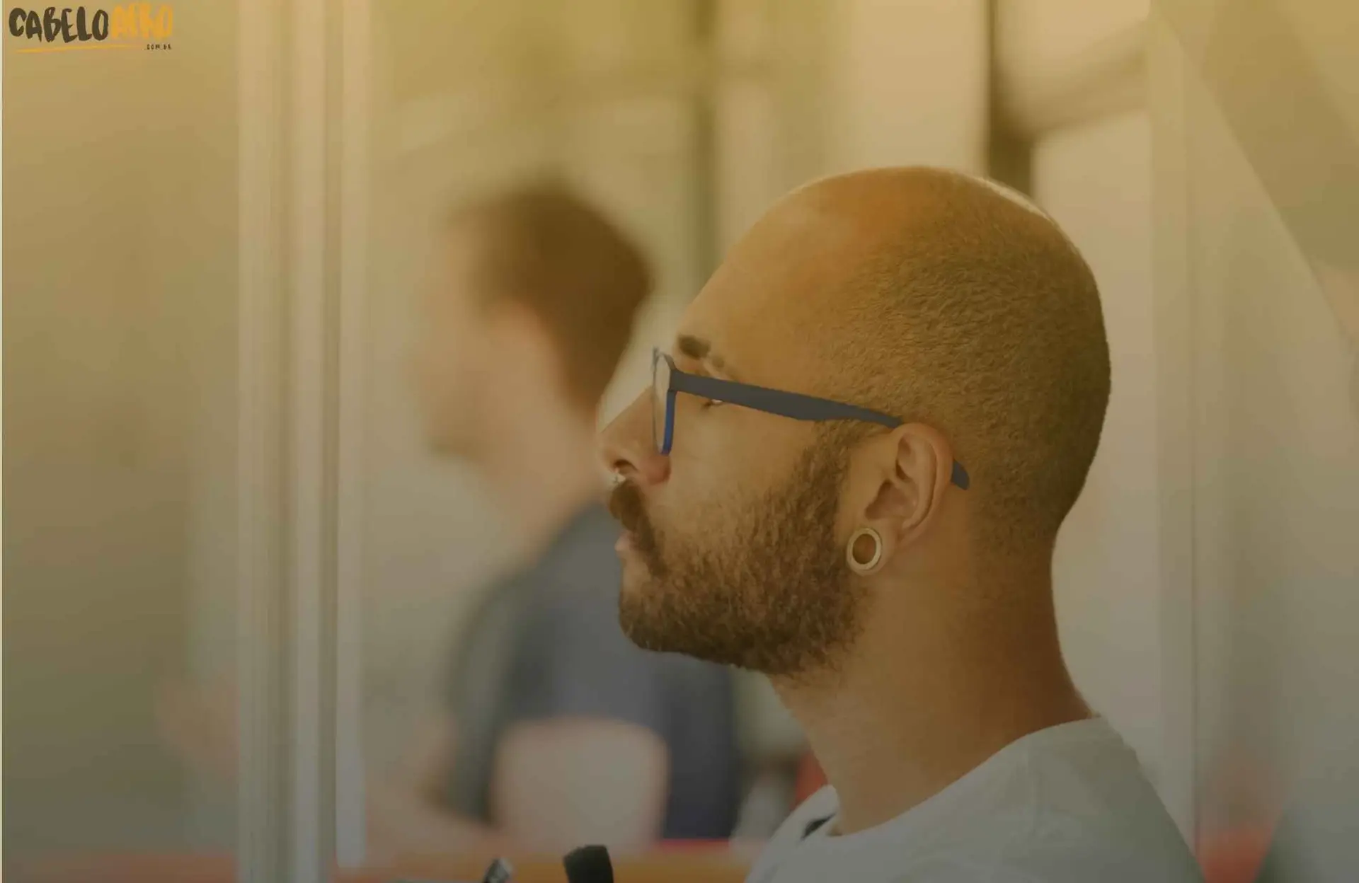 Calvice na região frontal do cabelo masculino: O que é?
